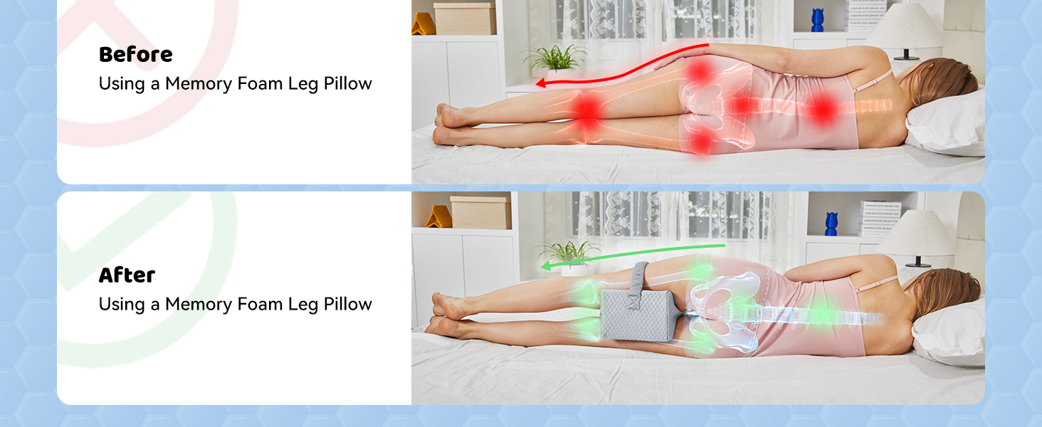 Cooling Leg Pillow for Side Sleepers and Sciatica Pain Relief
| Spine Aligning Support Knee Pillow for Hips and Join 91250f03 1af8 41b0 9609 1f6b1c8f2c12. CR0,0,1464,600 PT0 SX1464 V1