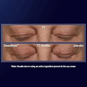 Anora eye cream before and after better than retinol