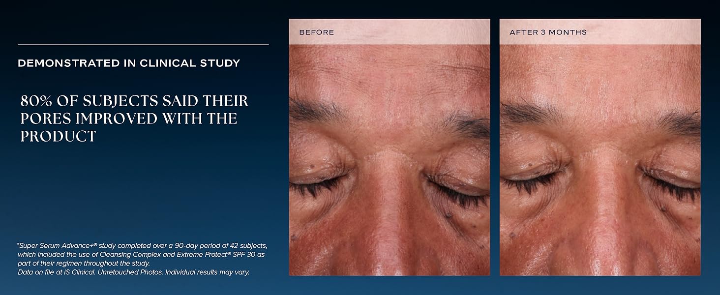 80% of subjects said their pores improbed with the product clinical study