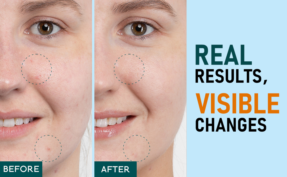 Turmeric Kojic Acid Cleansing Pads