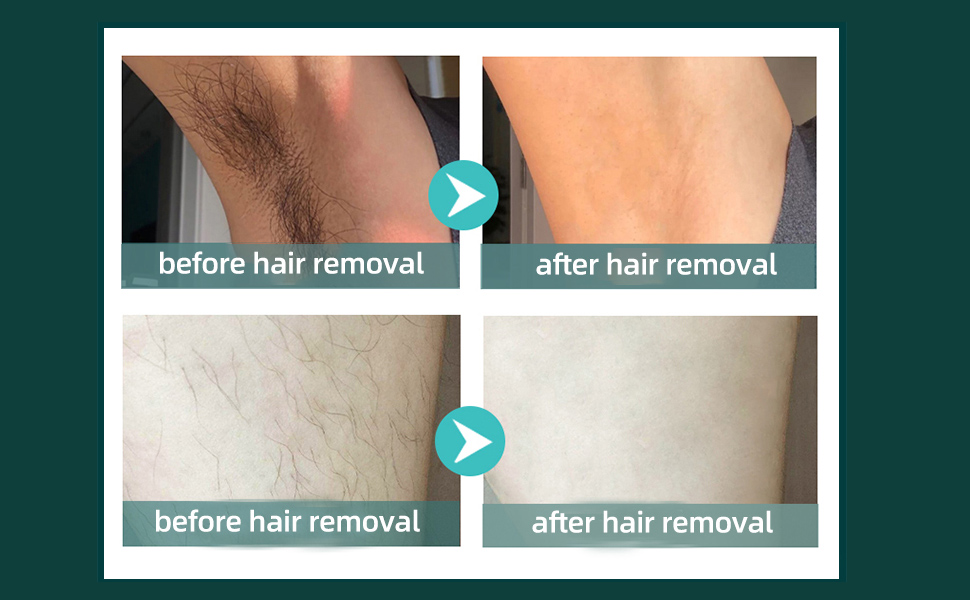 Permanent, Gentle and Painless