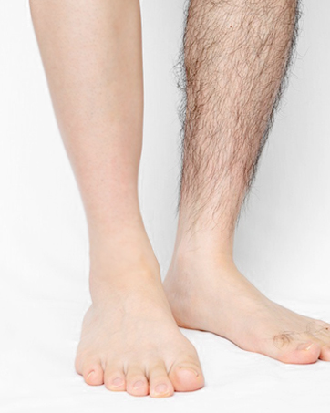 removal cream hair remover pubic hair removal cream