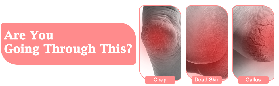 feet scrubber dead skin