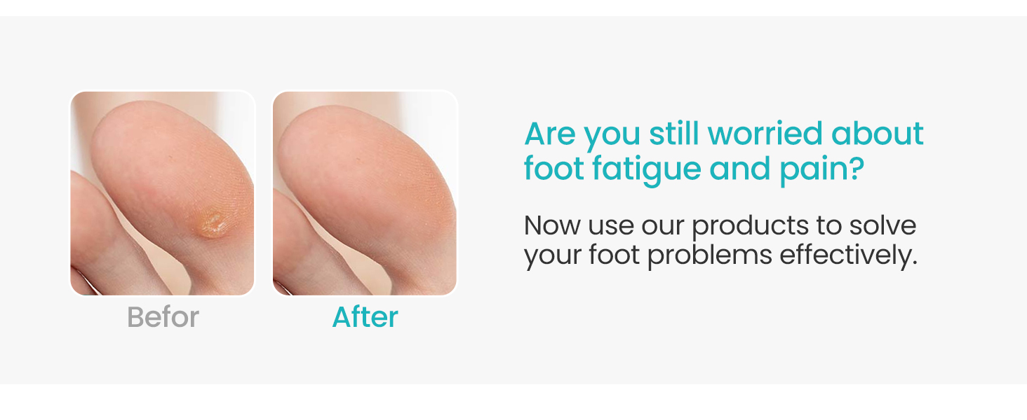 corn pads toes feet callous callus cushions for bottom of foot relive pain pressure blister foam