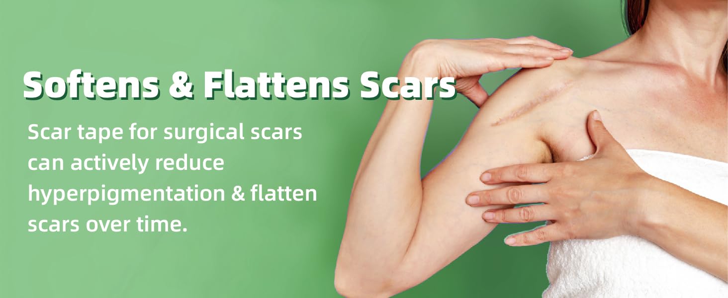 Silicone Scar Sheets