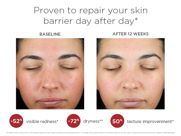 EltaMD UV Skin Recovery Facial Sunscreen