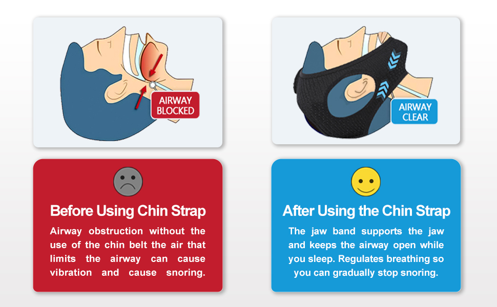 chin strap for snoring