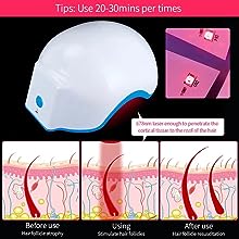 Laser Hair Growth System