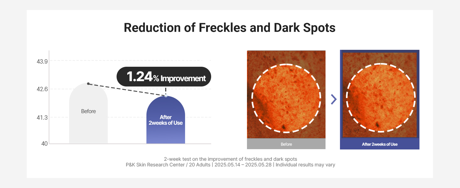 Dark Spots