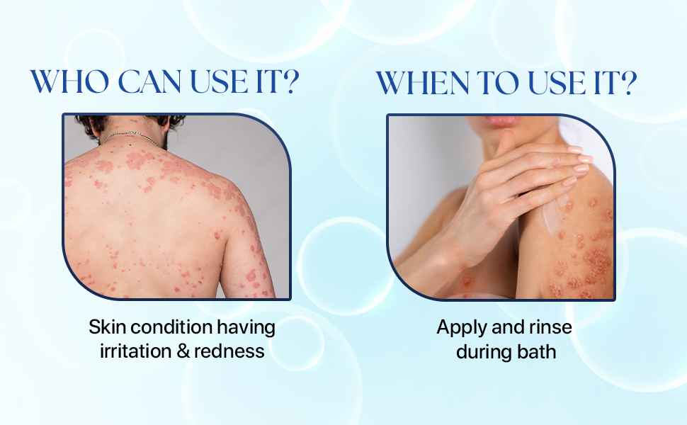 psoriasis body wash for skin