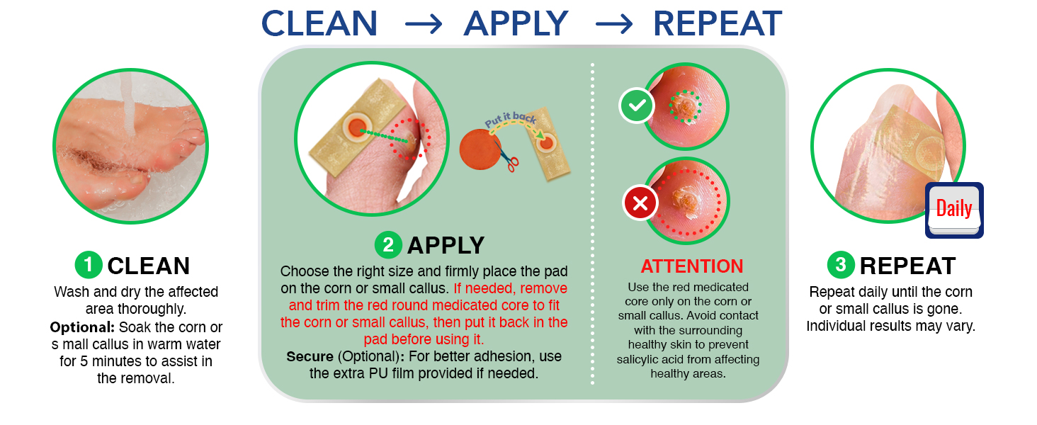 Corn Removal Simple 3-Step Application Process