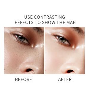 Dark Spot Corrector Remover for Face