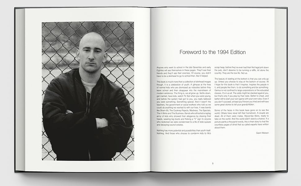 Skins: Gavin Watson (ACC Collector's Editions) : Watson, Gavin