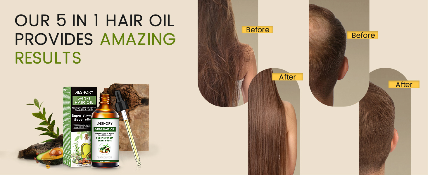 Rosemary Oil Hair Growth