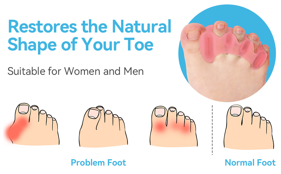 Restores the Natural Shape of Your Toe