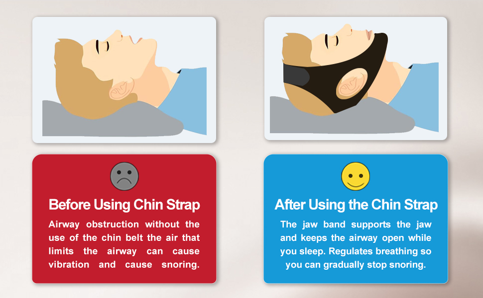 sleep apnea devices