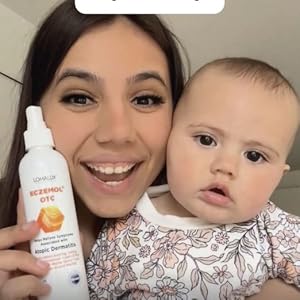 Eczemol OTC relieves baby eczema