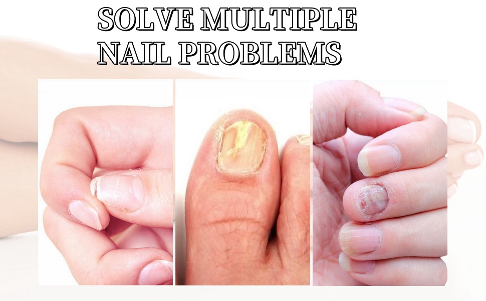 nail strengthener nail strengthener for damaged nails hardener nail repair nail fungal treatment