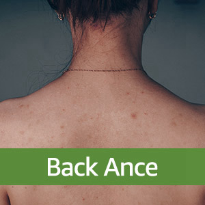 rückenbürste dusche