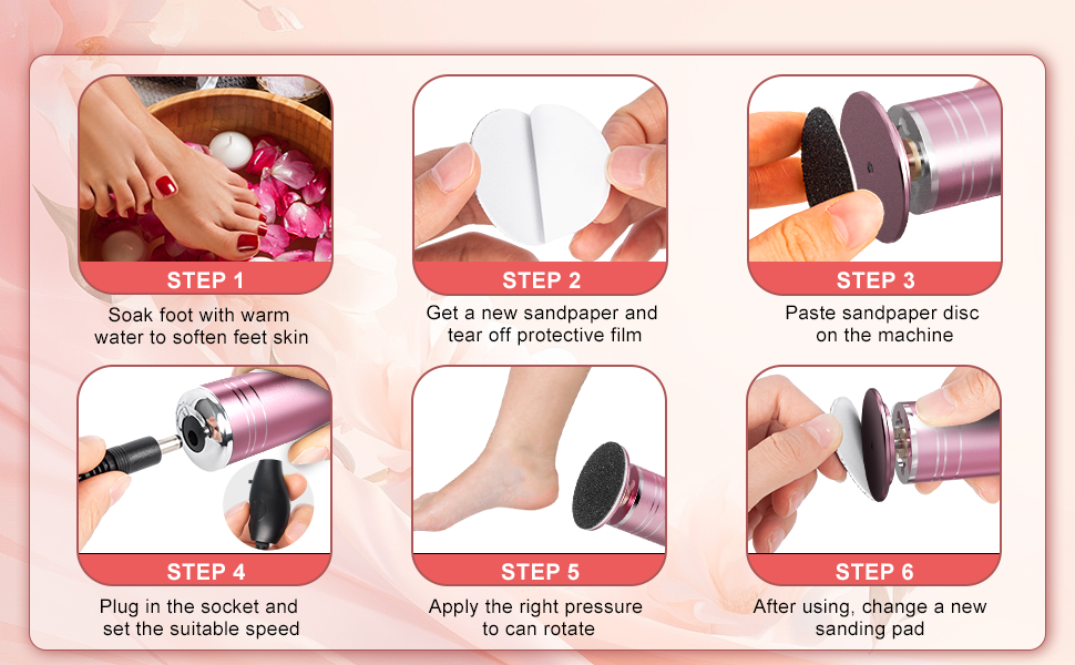 electric callus remover