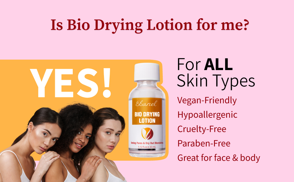 acne drying lotion