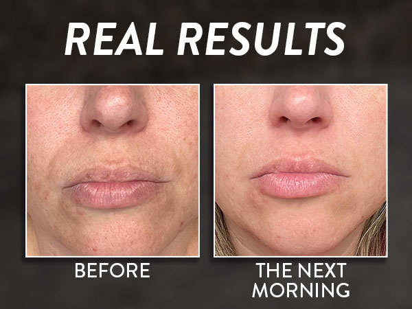 Before and After Real Results