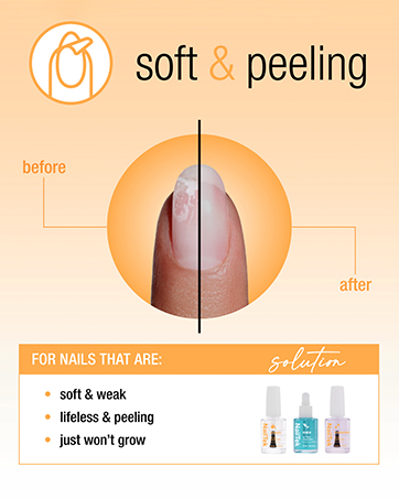 Nail Tek