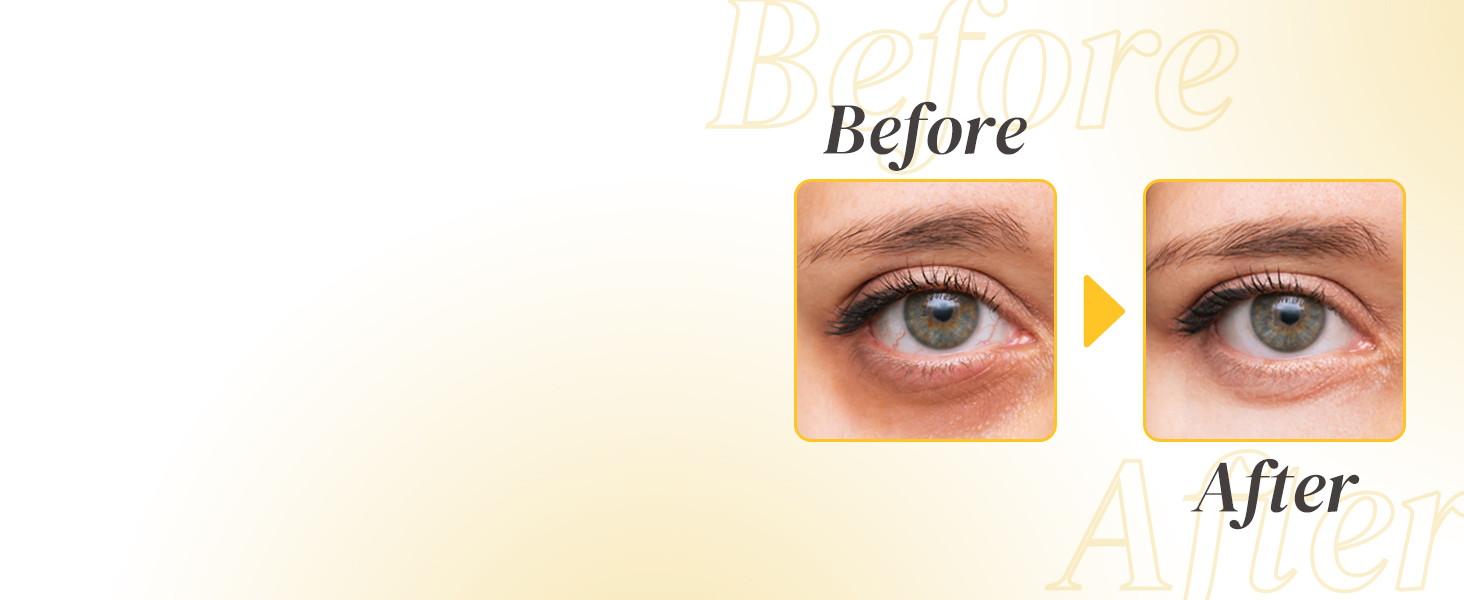 Enaskin Naturals Under Eye Gel Patches