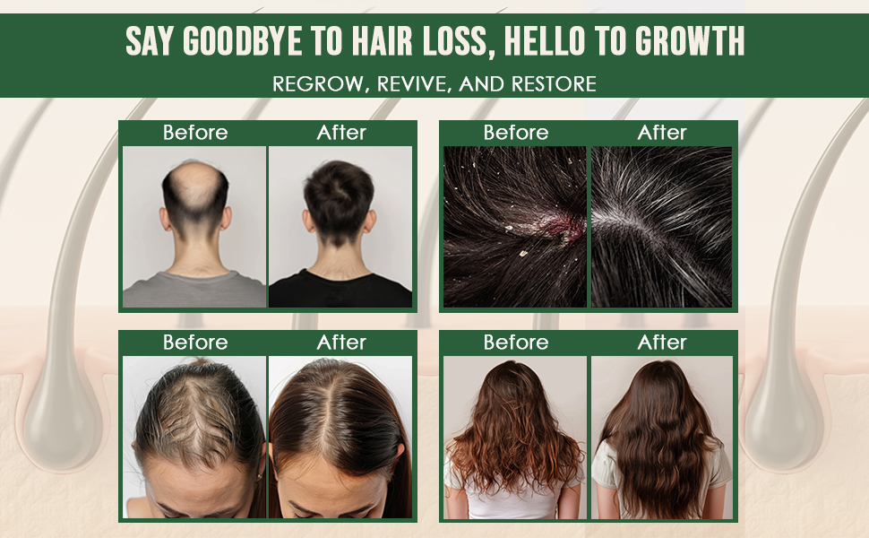 Banatan Oil, Botona Oil, Pure Batana Oil, Batana Oil, Batana oil organic, Botana Oil, Batna oil