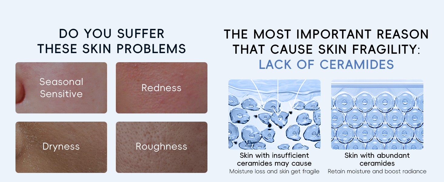 ceramide skincare 