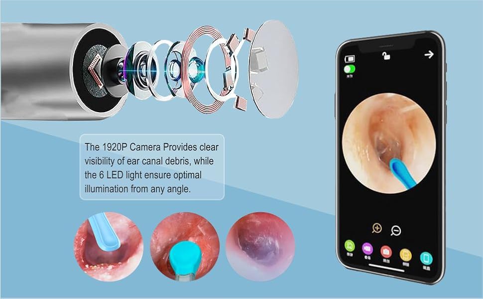 ear cleaner with camera
