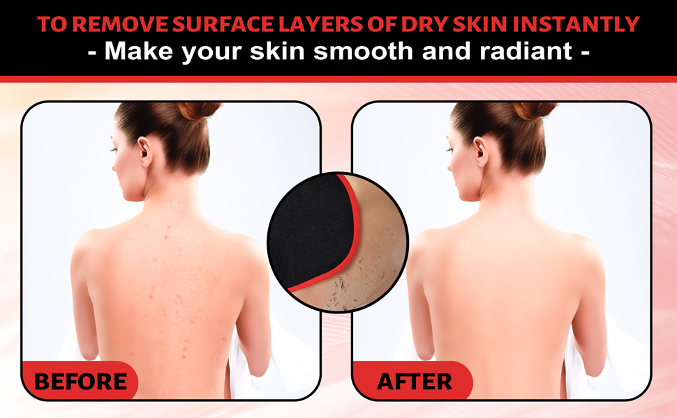 body exfoliator for dead skin