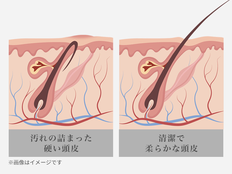 ヘッドリラクゼーション Amazon | 【博士監修】NIPLUX HEAD SPA 電動頭皮ブラシ 株式会社