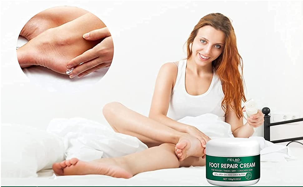 Scarman Urea 42 Foot Cream, Healing Foot Repair Cream for