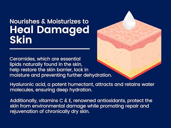 Dermeleve Anti-Itch Cream