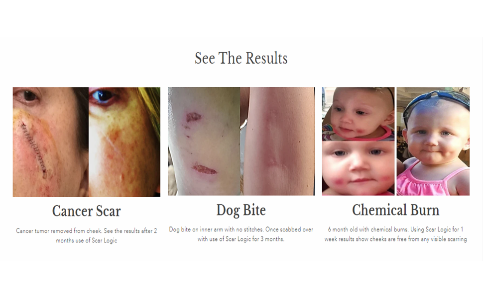 See the results of our Scar Logic