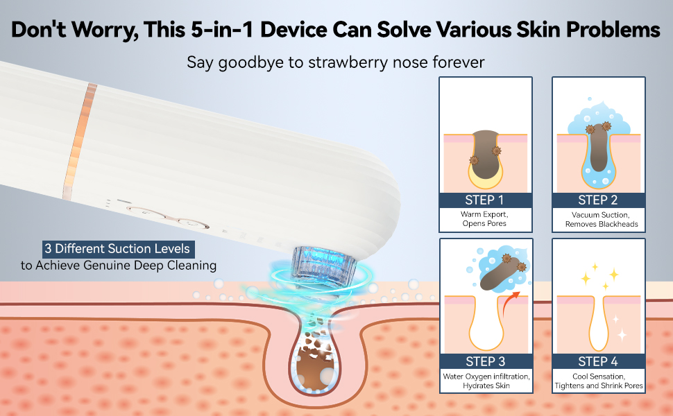Don't Worry, This 5-in-1 Device Can Solve Various Skin Problems