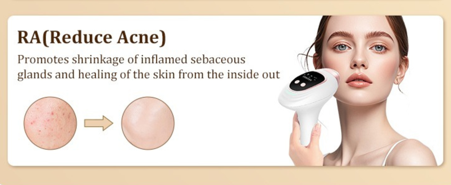 innza laser hair removal