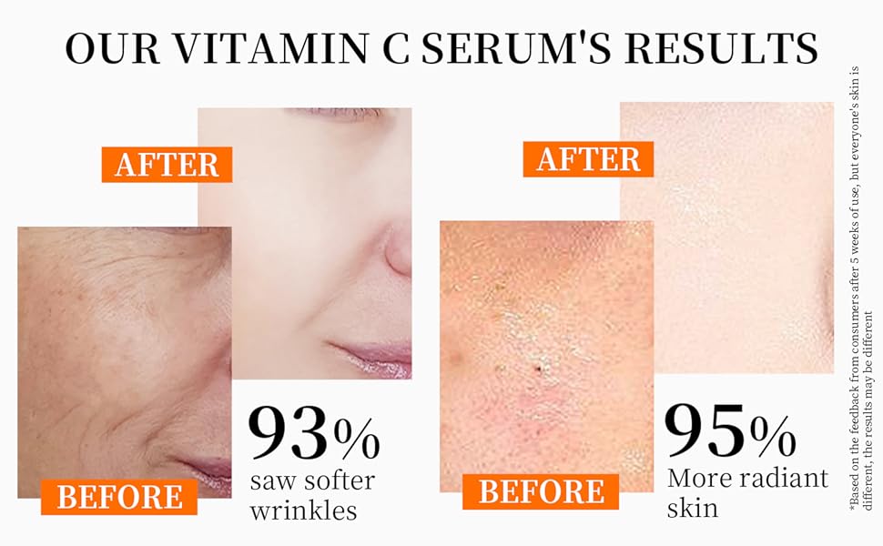 our vitamin c serum's results