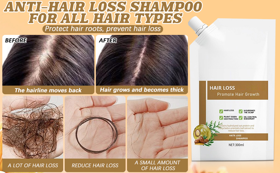 Nourishing Conditioning Anti Hair Loss Shampoo That Provides Nutrition Deep Into Hair Roots