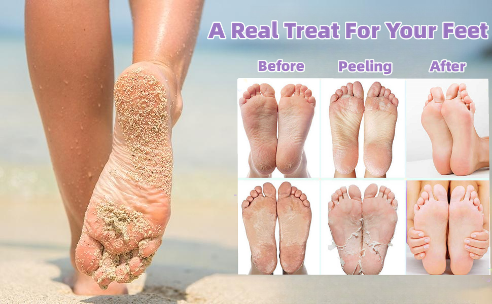 Peel off Dead Skin Peeling Feet Mask