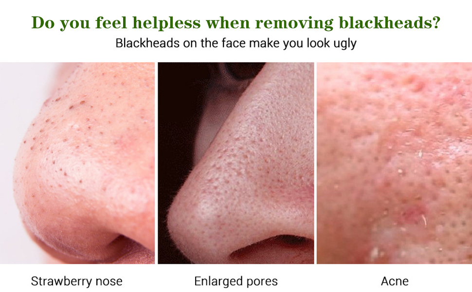 Amazon.com: Blackhead Remover Mask(2 Pack), Nose Pore Strips for Black ...