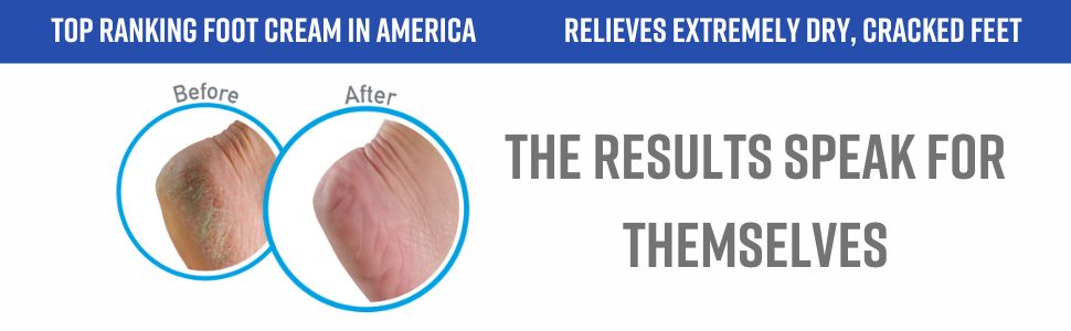 White Backing - F&Bs