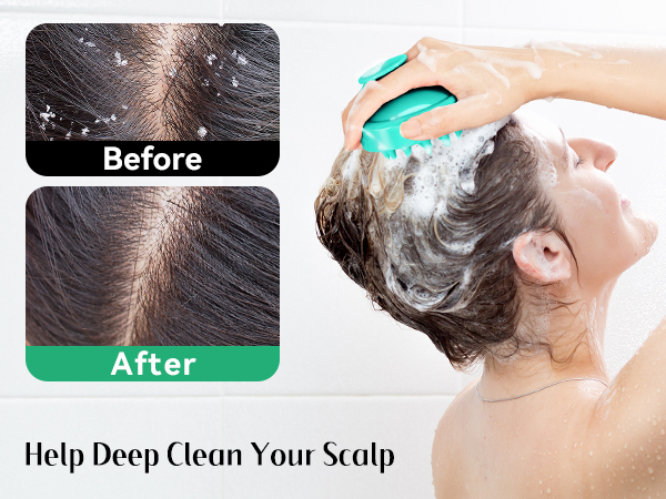 scalp scrubber