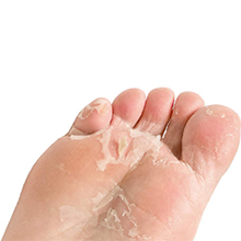 Feet Peeling Mask for Removes Dry Dead Skin, Cracked Heels &Calluses