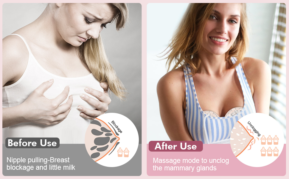 Wearable Breast Pump
