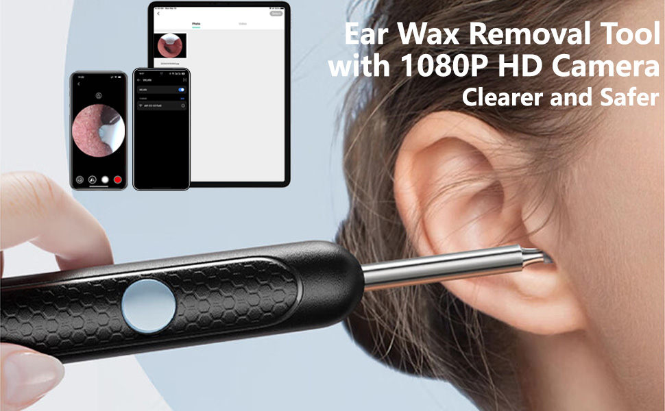 Advanced HD Camera & Real-Time Viewing