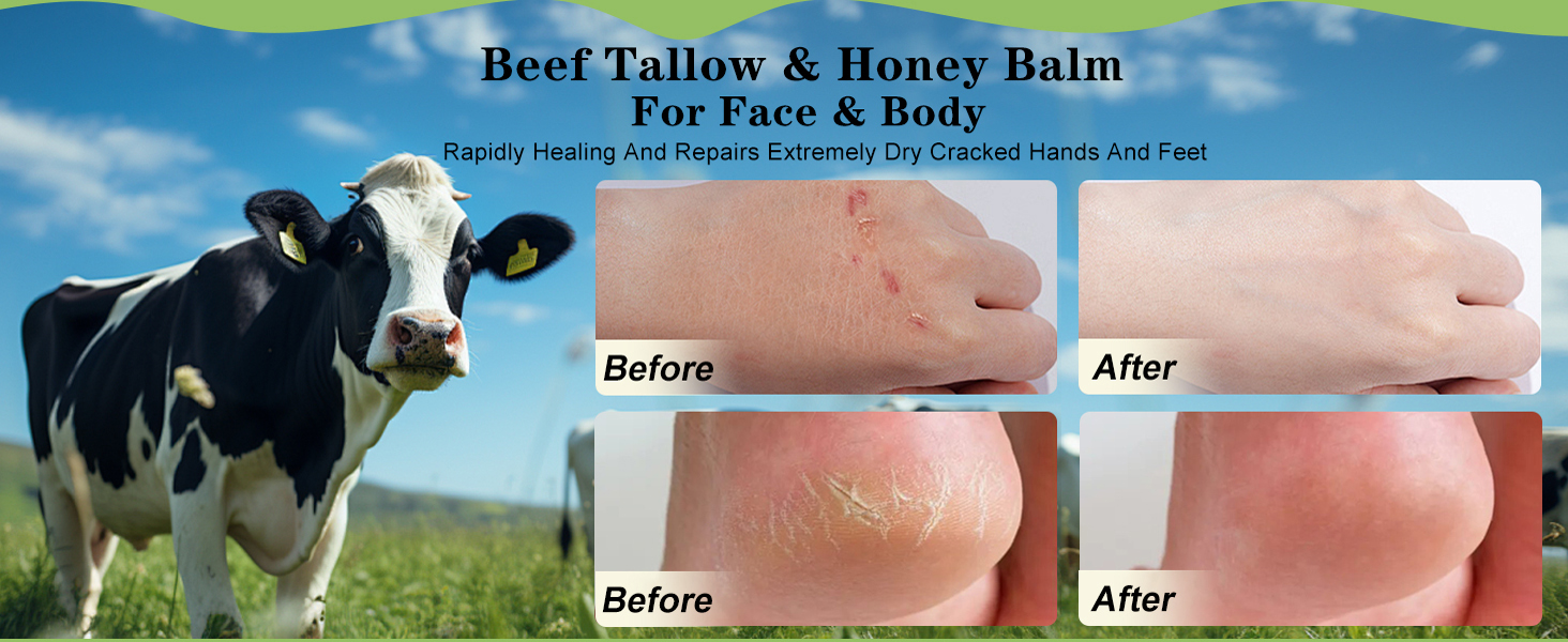 Repairs Extremely Dry Cracked Hands And Feet