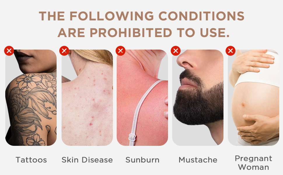 light hair removal devices