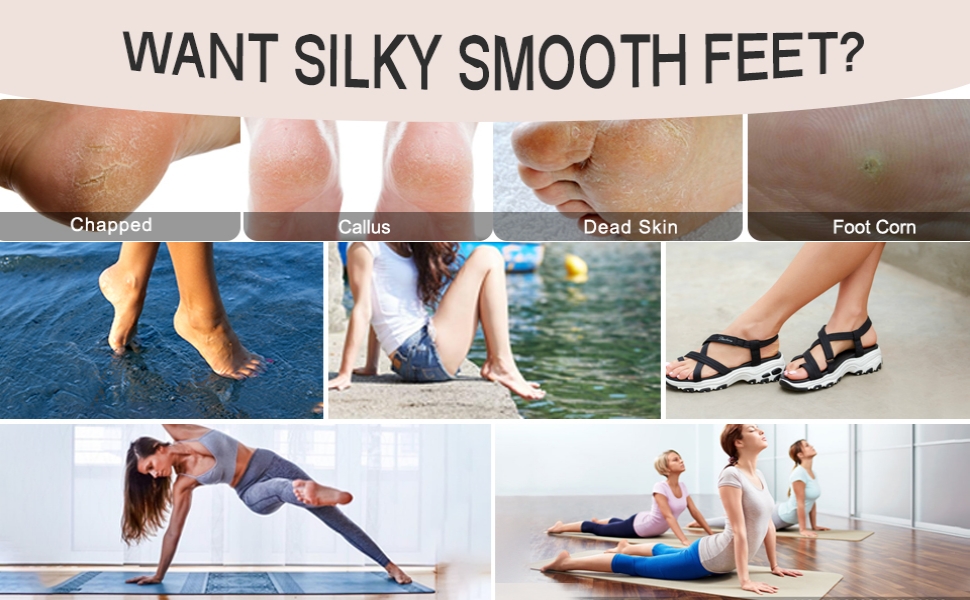 electric feet callus remover for feet pedicure tools for feet